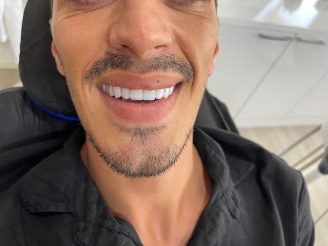 Dental image 3-2