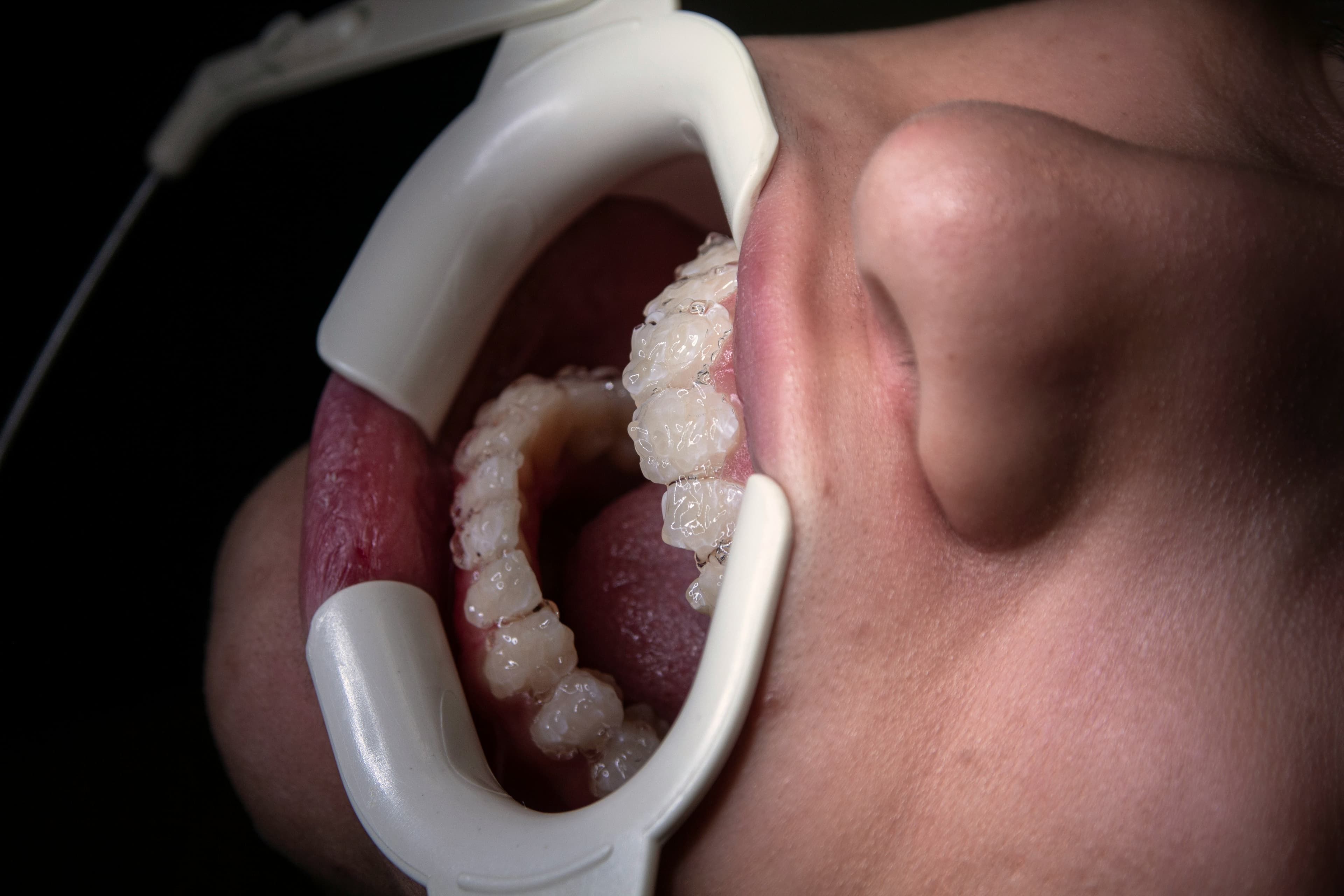 Endodontics