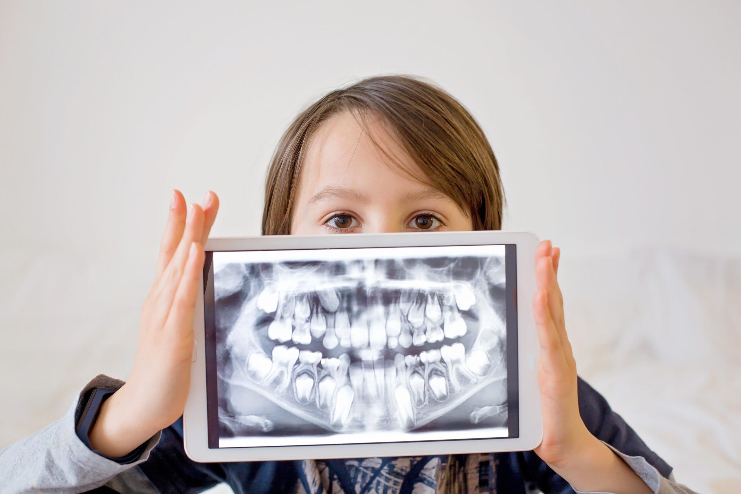 Digital X-rays and Diagnostics