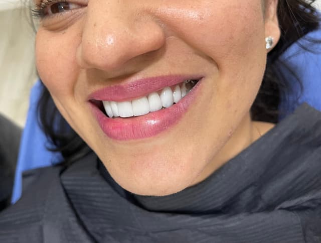Dental image 3-0
