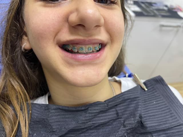 Dental image 1-3
